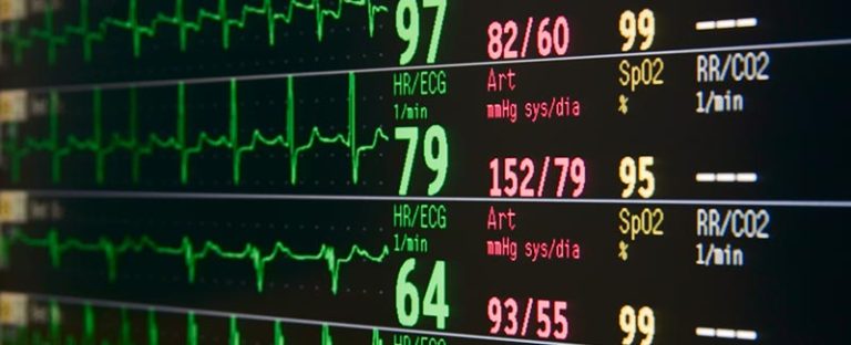 testosterone supplementation improves T2 diabetes - cardiac graphs