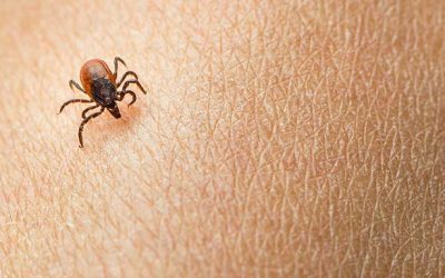 Permethrin Kills Ticks and Prevents Lyme Disease — Summer 2018