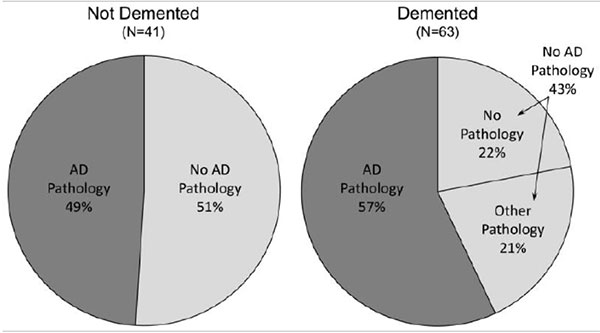 pathology demented brains pie charts
